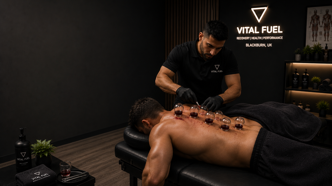 How Often Should You Do Hijama Therapy?